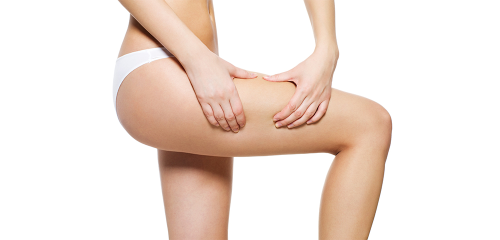 colagenesa-celulitis